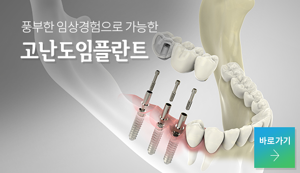 고난도 임플란트