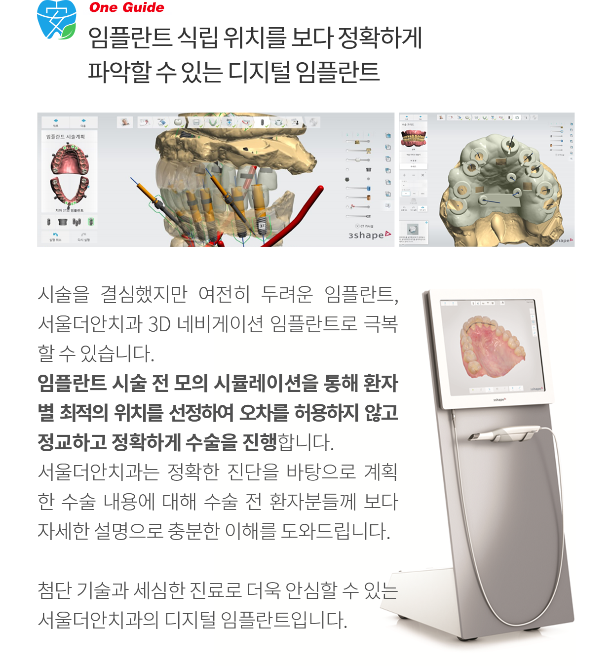 네비게이션 임플란트 장점