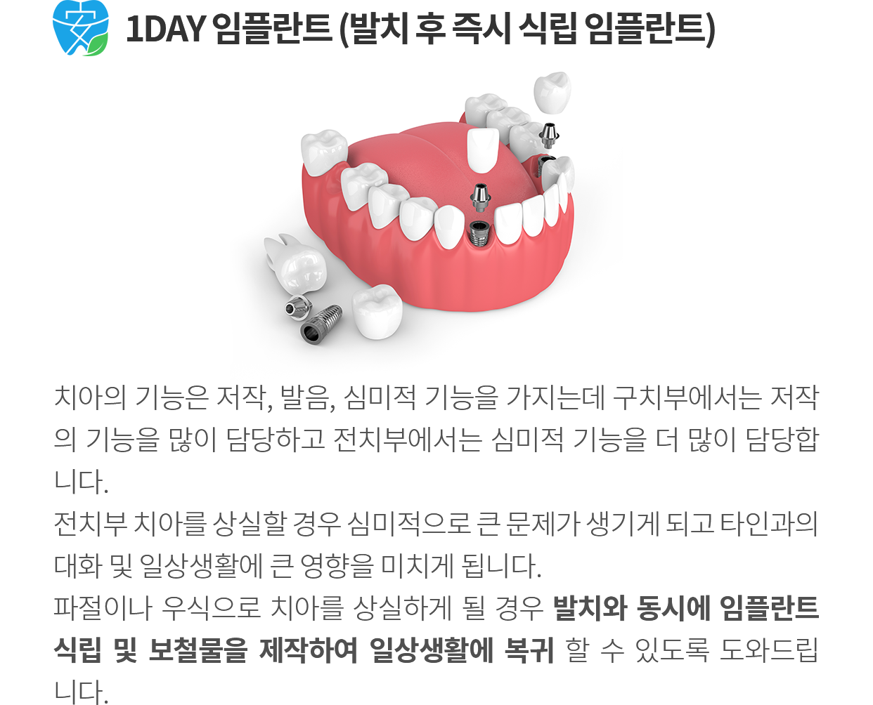고난도 임플란트 장점