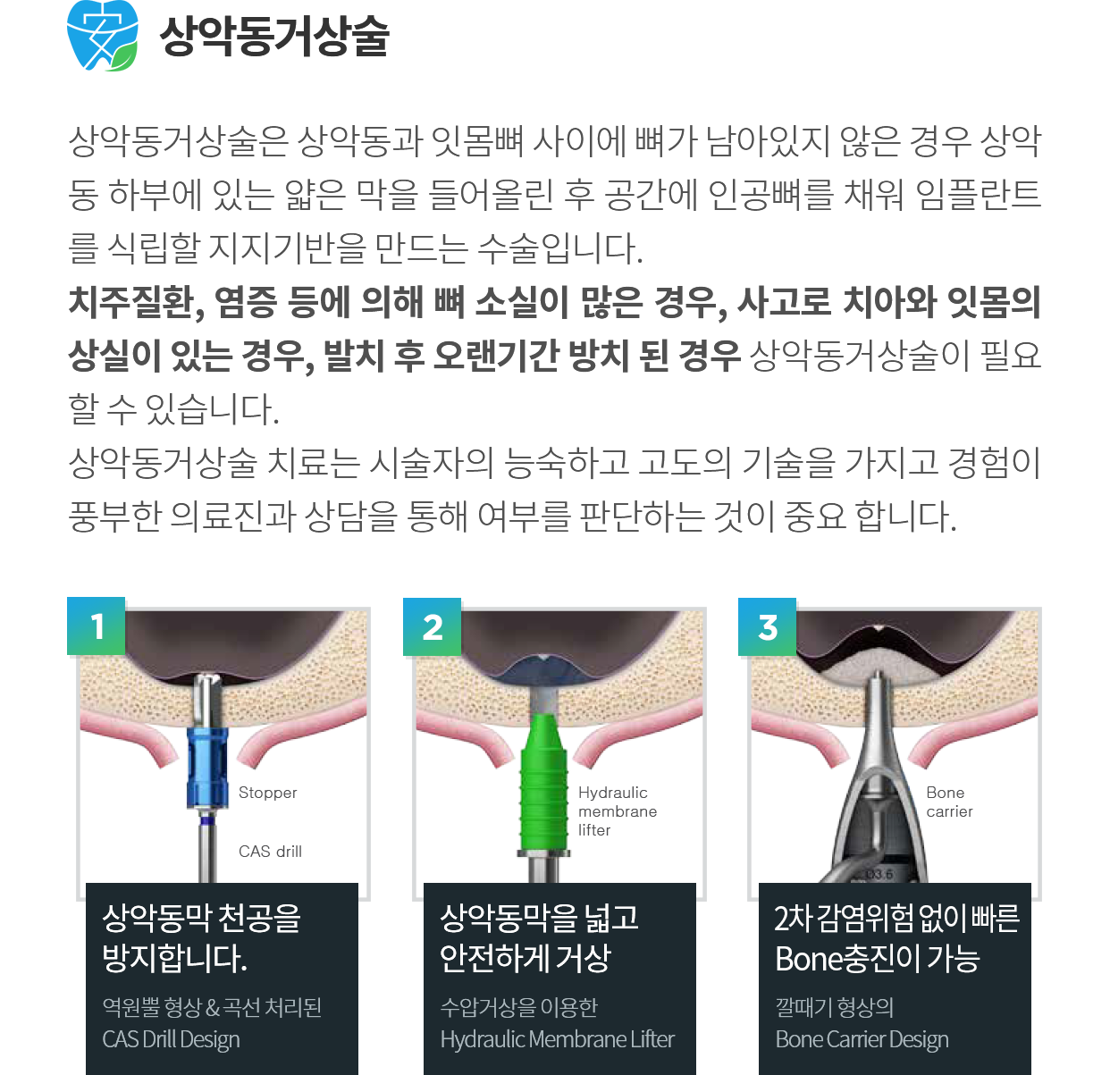 고난도 임플란트 과정