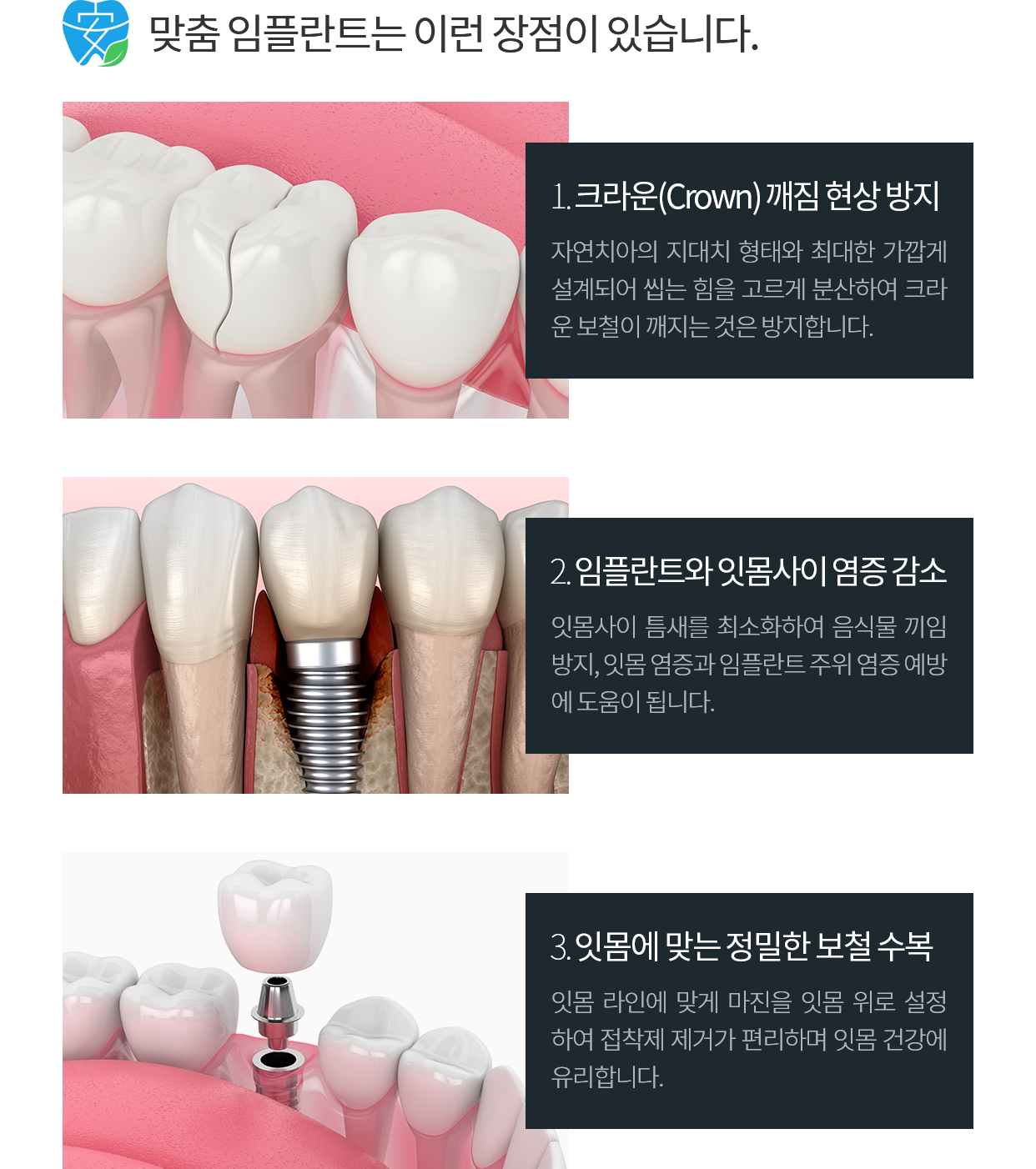 맞춤 임플란트 장점