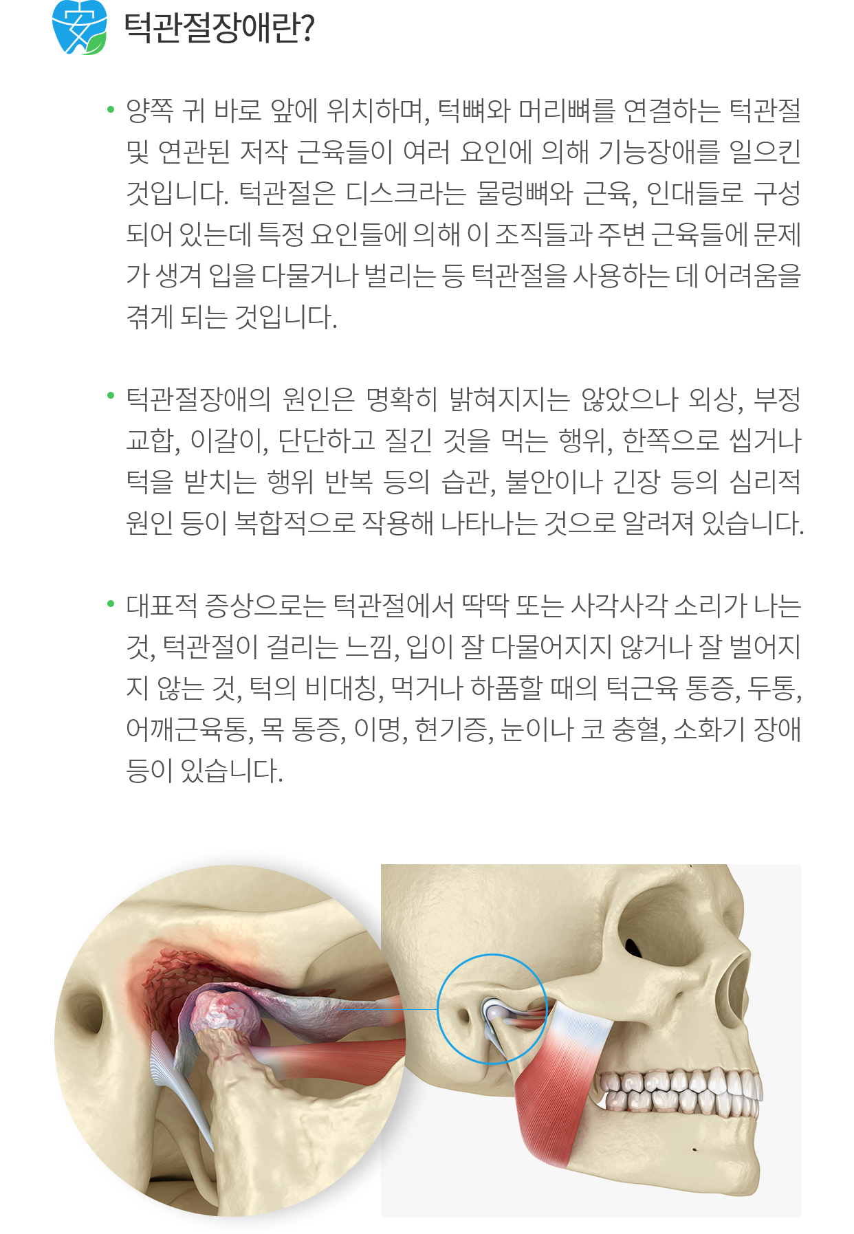 턱관절 장애 소개
