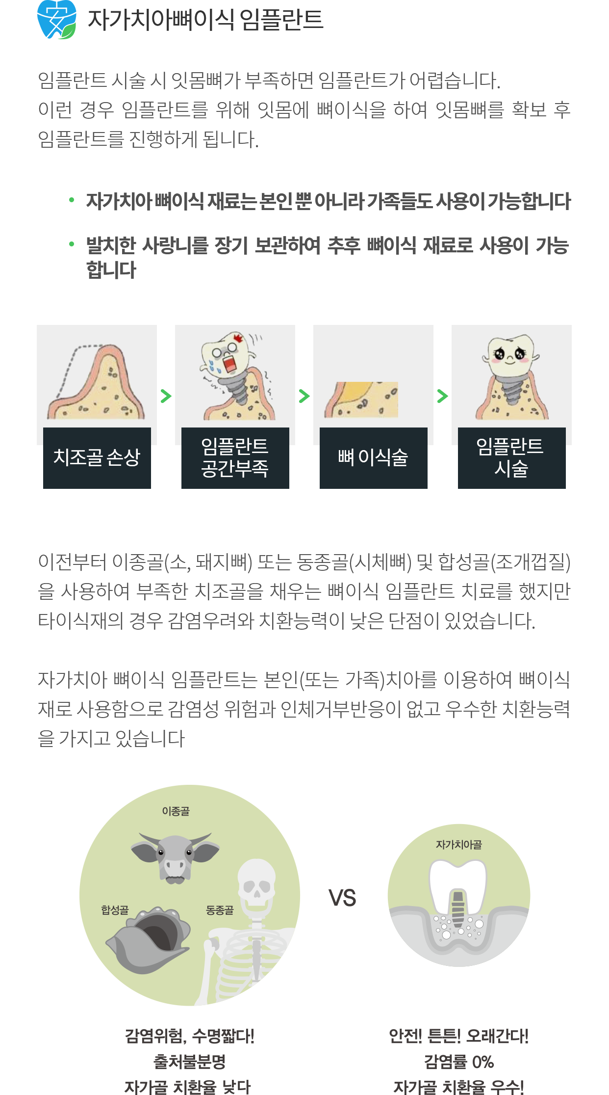 자가치아 뼈이식 절차 소개