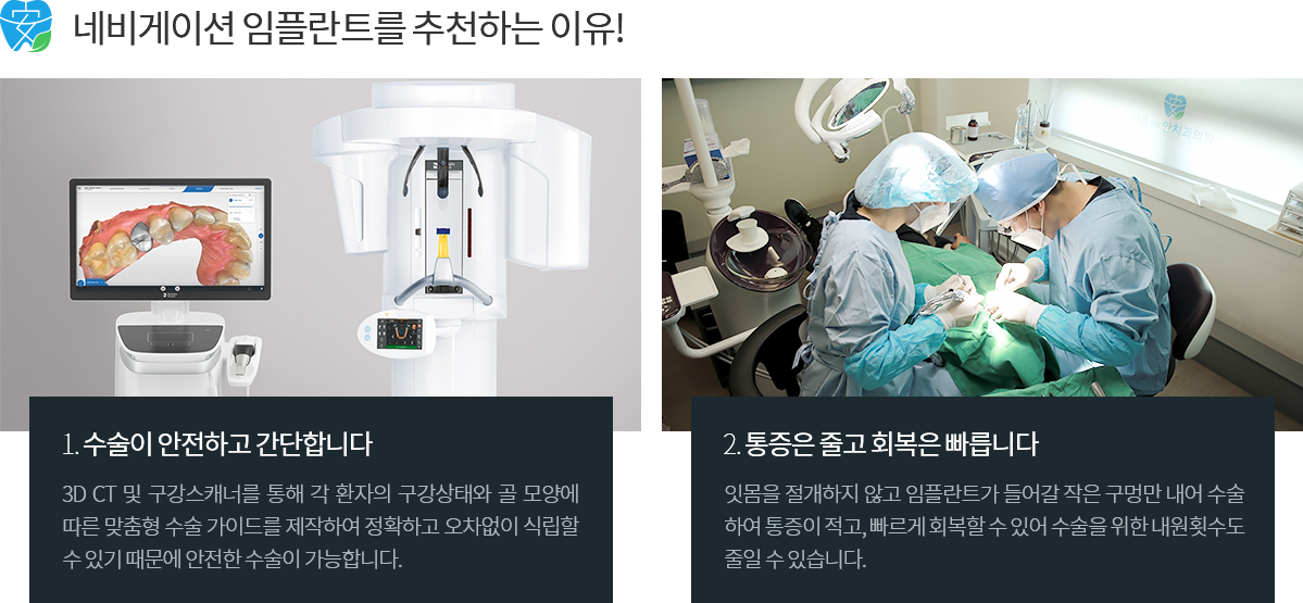 네비게이션 임플란트 소개