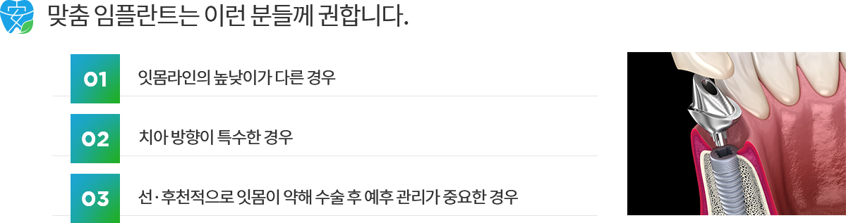 맞춤 임플란트 소개