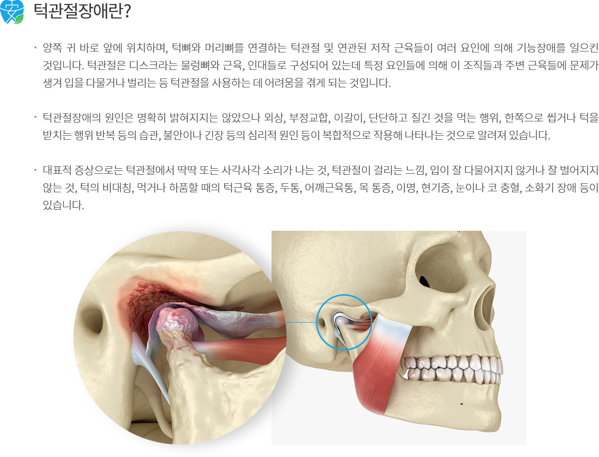 턱관절 장애 소개