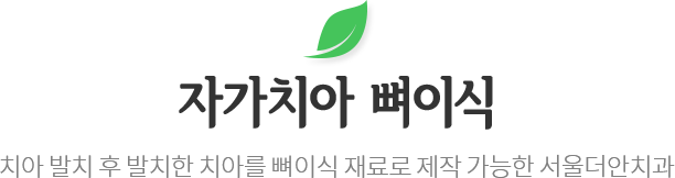 자가치아 뼈이식